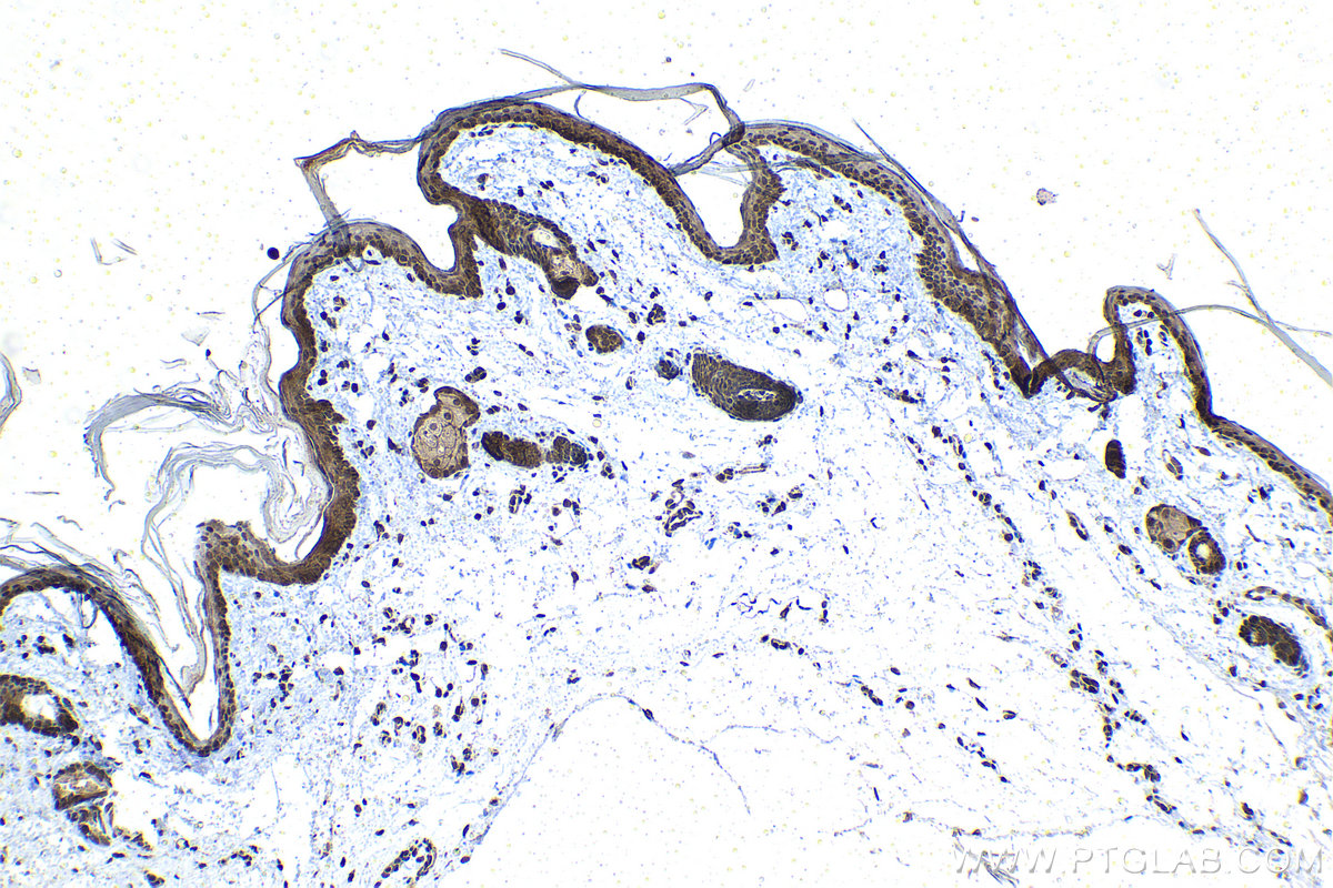 Immunohistochemical analysis of paraffin-embedded rat skin tissue slide using KHC1477 (PSMD10 IHC Kit).