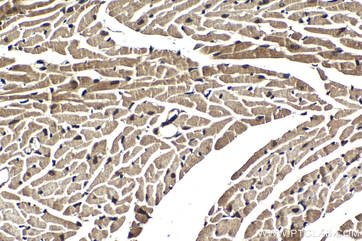 Immunohistochemical analysis of paraffin-embedded mouse heart tissue slide using KHC2047 (PSMD14 IHC Kit).