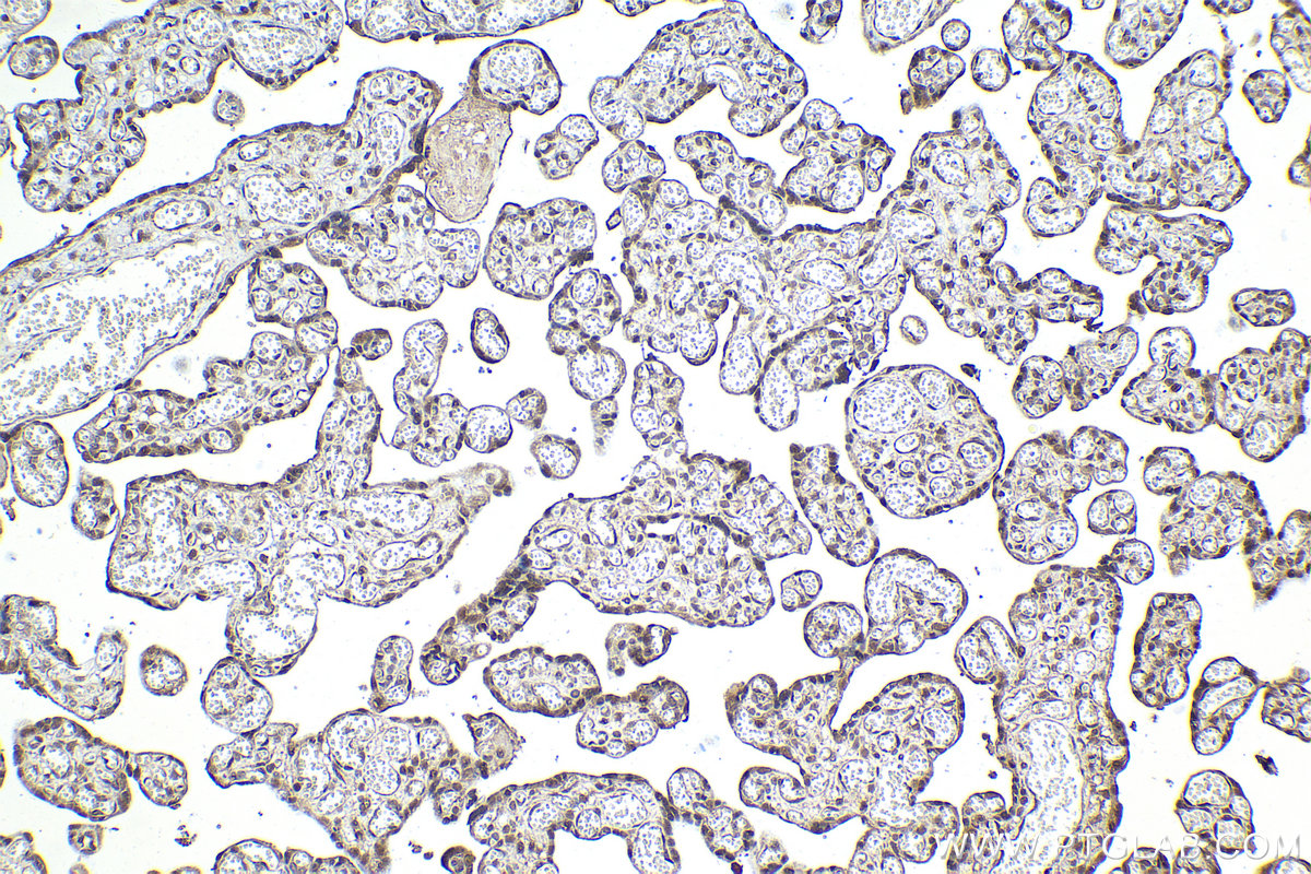 Immunohistochemical analysis of paraffin-embedded human placenta tissue slide using KHC2047 (PSMD14 IHC Kit).