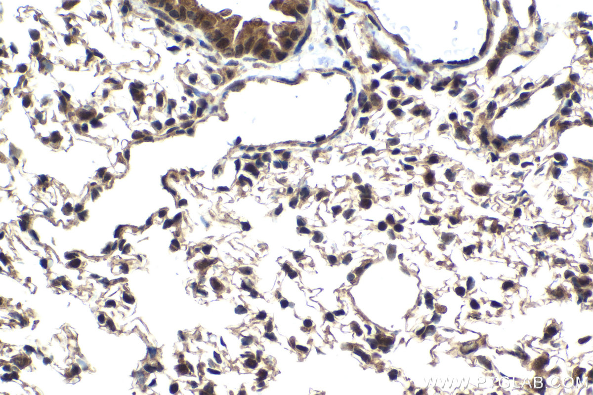Immunohistochemical analysis of paraffin-embedded mouse lung tissue slide using KHC2047 (PSMD14 IHC Kit).