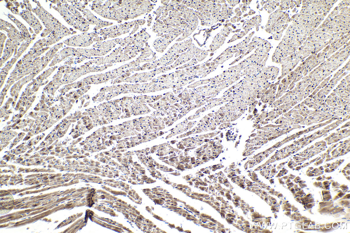 Immunohistochemical analysis of paraffin-embedded rat heart tissue slide using KHC2047 (PSMD14 IHC Kit).