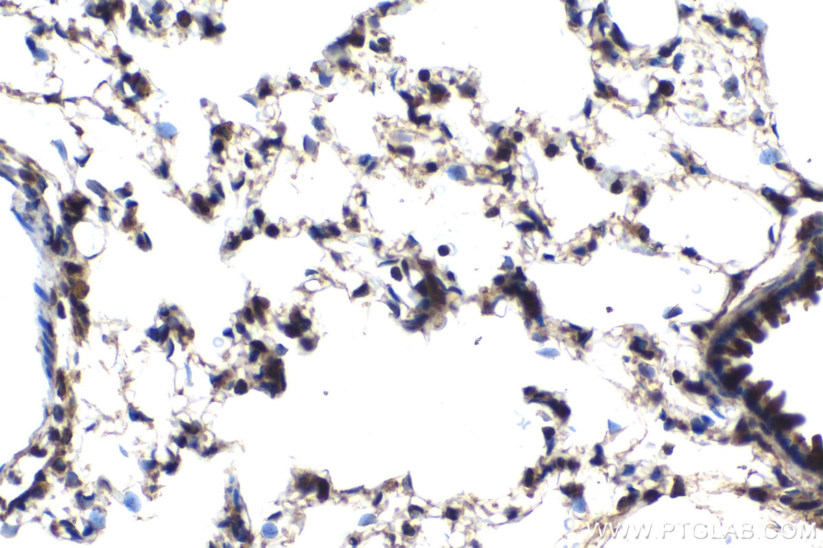 Immunohistochemical analysis of paraffin-embedded rat lung tissue slide using KHC2047 (PSMD14 IHC Kit).