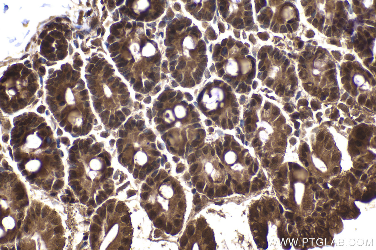 Immunohistochemical analysis of paraffin-embedded mouse intestine tissue slide using KHC2075 (PSMD3 IHC Kit).