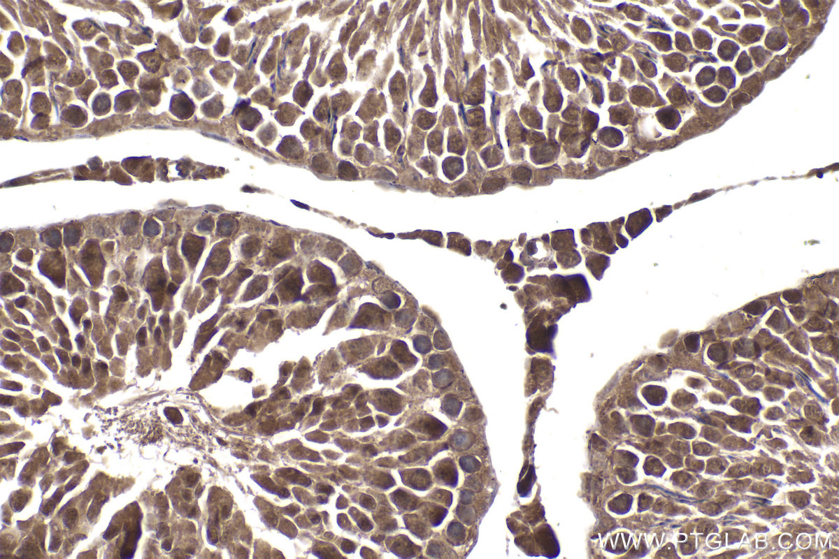Immunohistochemical analysis of paraffin-embedded rat testis tissue slide using KHC2075 (PSMD3 IHC Kit).