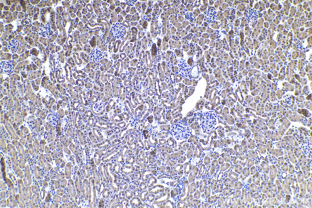 Immunohistochemical analysis of paraffin-embedded mouse kidney tissue slide using KHC0943 (PSMD7 IHC Kit).