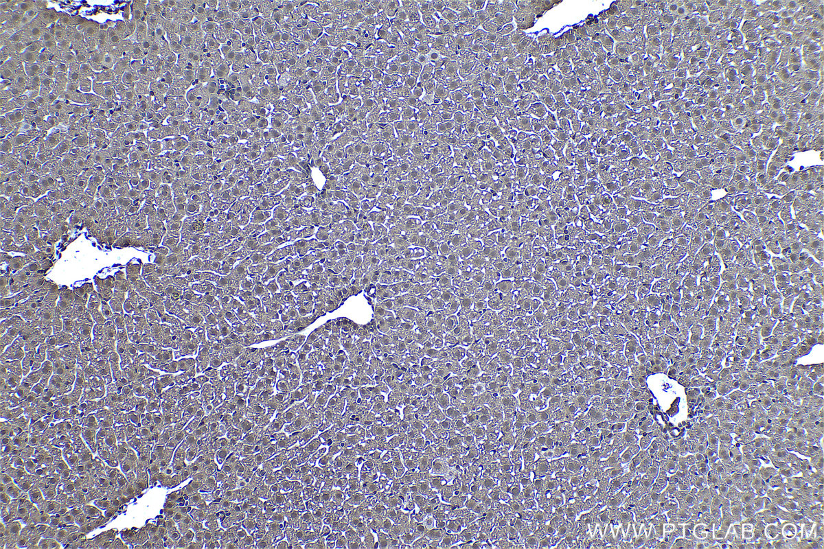 Immunohistochemical analysis of paraffin-embedded mouse liver tissue slide using KHC0449 (PSME2 IHC Kit).