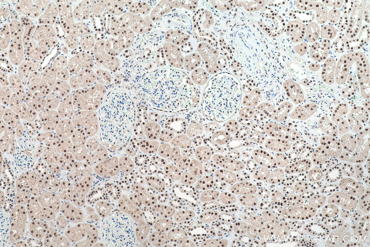 Immunohistochemical analysis of paraffin-embedded human kidney tissue slide using KHC0764 (PSME3 IHC Kit).