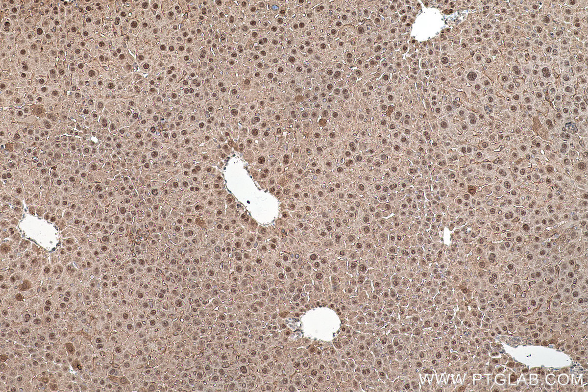 Immunohistochemical analysis of paraffin-embedded mouse liver tissue slide using KHC0764 (PSME3 IHC Kit).