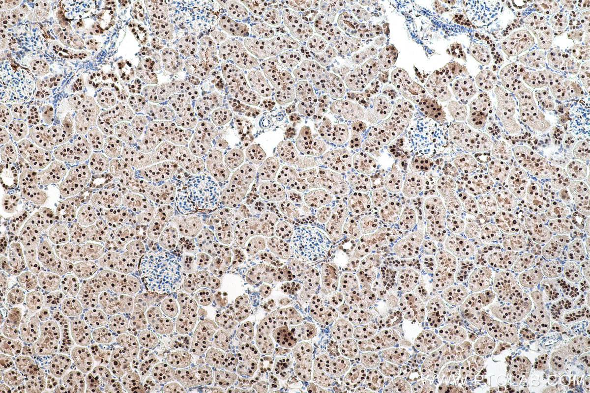 Immunohistochemical analysis of paraffin-embedded rat kidney tissue slide using KHC0764 (PSME3 IHC Kit).