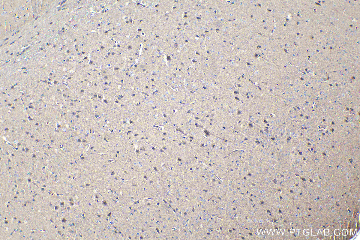 Immunohistochemical analysis of paraffin-embedded mouse brain tissue slide using KHC1033 (PSMG1 IHC Kit).