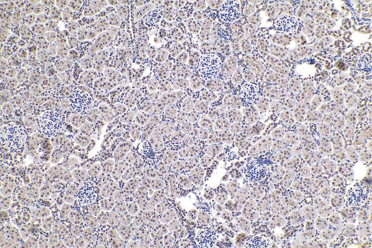 Immunohistochemical analysis of paraffin-embedded rat kidney tissue slide using KHC0667 (PTBP1 IHC Kit).