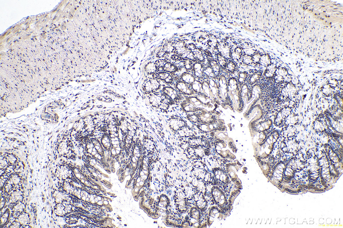 Immunohistochemical analysis of paraffin-embedded rat colon tissue slide using KHC0667 (PTBP1 IHC Kit).