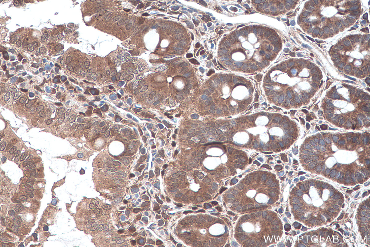 Immunohistochemical analysis of paraffin-embedded rat colon tissue slide using KHC0280 (PTEN IHC Kit).