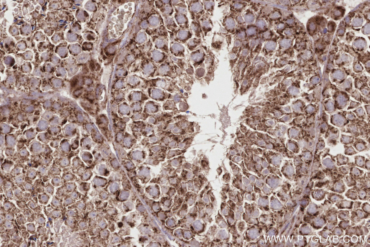 Immunohistochemical analysis of paraffin-embedded mouse testis tissue slide using KHC2838 (PTPIP51 IHC Kit).