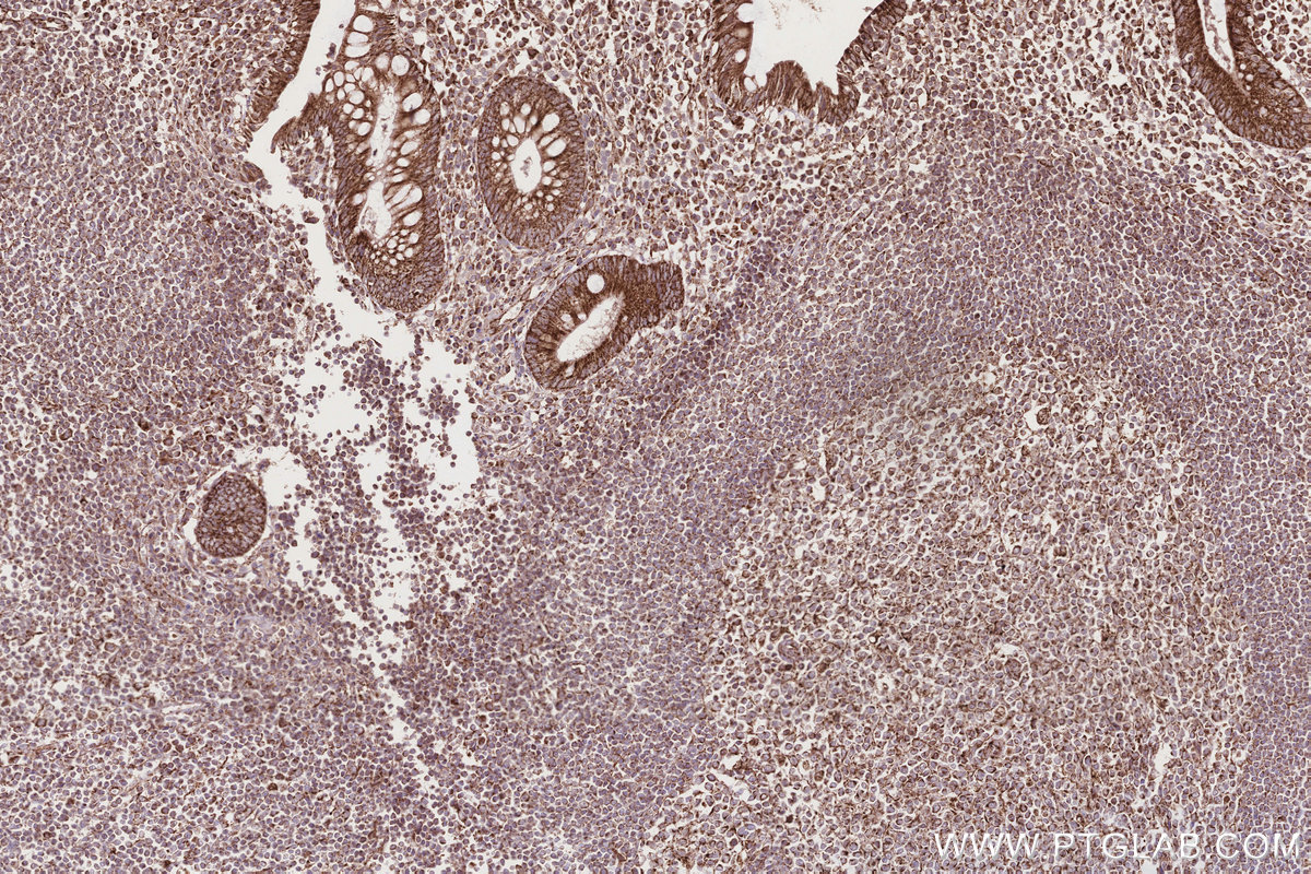 Immunohistochemical analysis of paraffin-embedded human appendicitis tissue slide using KHC2838 (PTPIP51 IHC Kit).