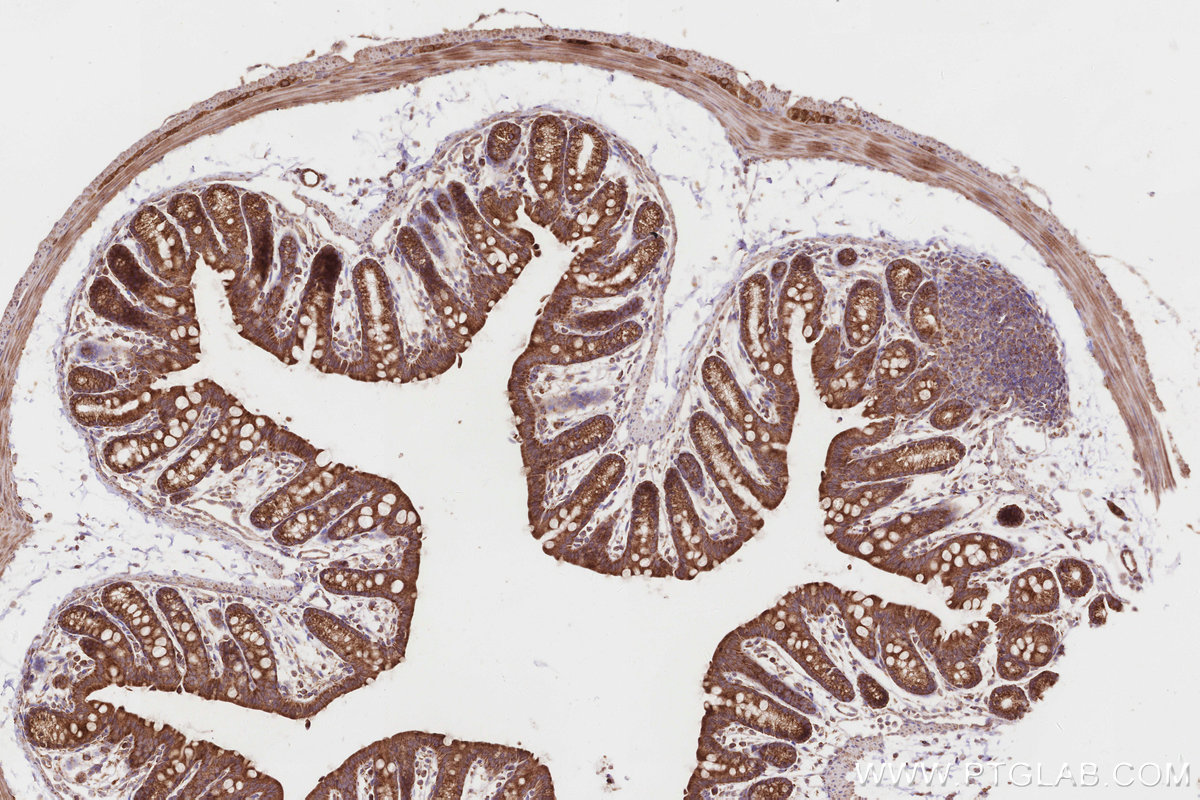 Immunohistochemical analysis of paraffin-embedded mouse colon tissue slide using KHC2838 (PTPIP51 IHC Kit).