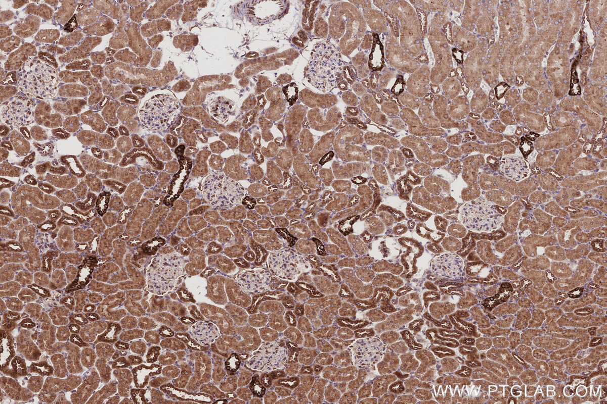 Immunohistochemical analysis of paraffin-embedded rat kidney tissue slide using KHC2983 (PTPLAD1 IHC Kit). Immunohistochemical analysis of paraffin-embedded rat kidney tissue slide using KHC2983 (PTPLAD1 IHC Kit).