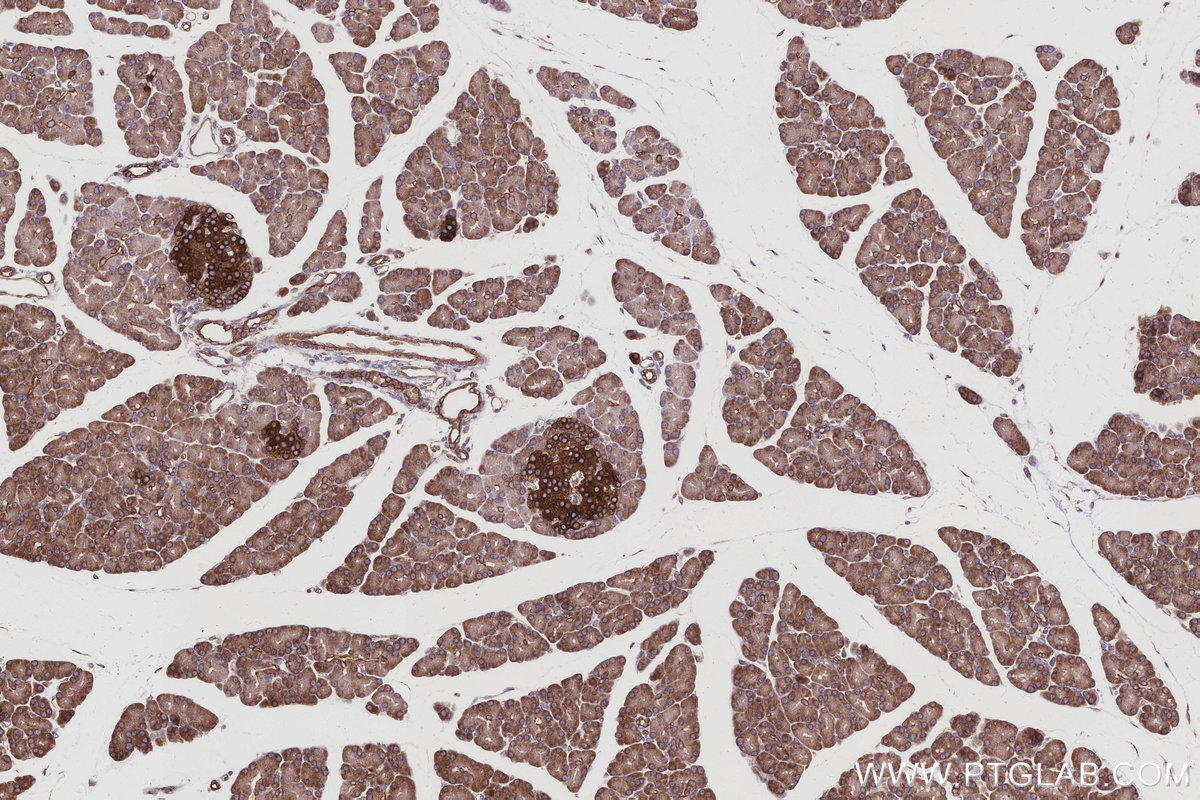 Immunohistochemical analysis of paraffin-embedded rat pancreas tissue slide using KHC2983 (PTPLAD1 IHC Kit). Immunohistochemical analysis of paraffin-embedded rat pancreas tissue slide using KHC2983 (PTPLAD1 IHC Kit).
