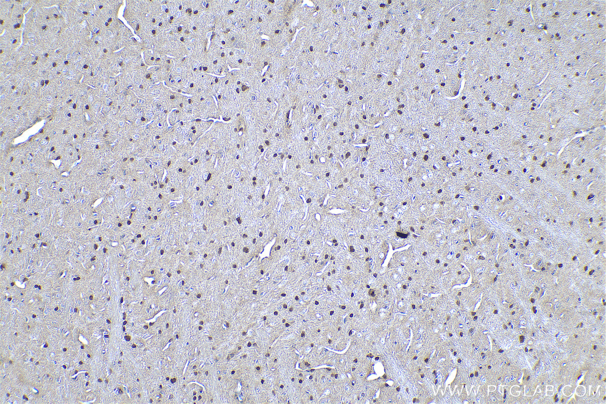 Immunohistochemical analysis of paraffin-embedded rat brain tissue slide using KHC0964 (PTPN11 IHC Kit).