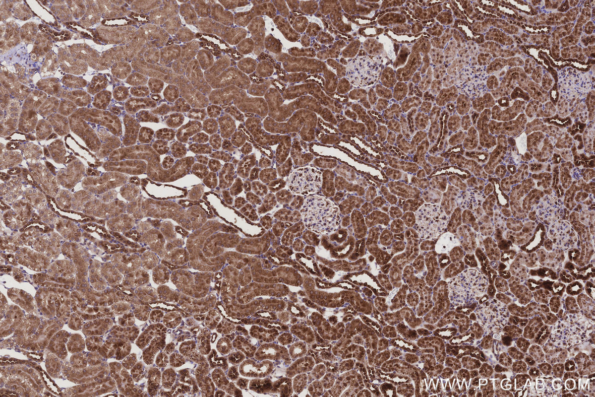 Immunohistochemical analysis of paraffin-embedded rat kidney tissue slide using KHC3210 (PTPN9 IHC Kit).