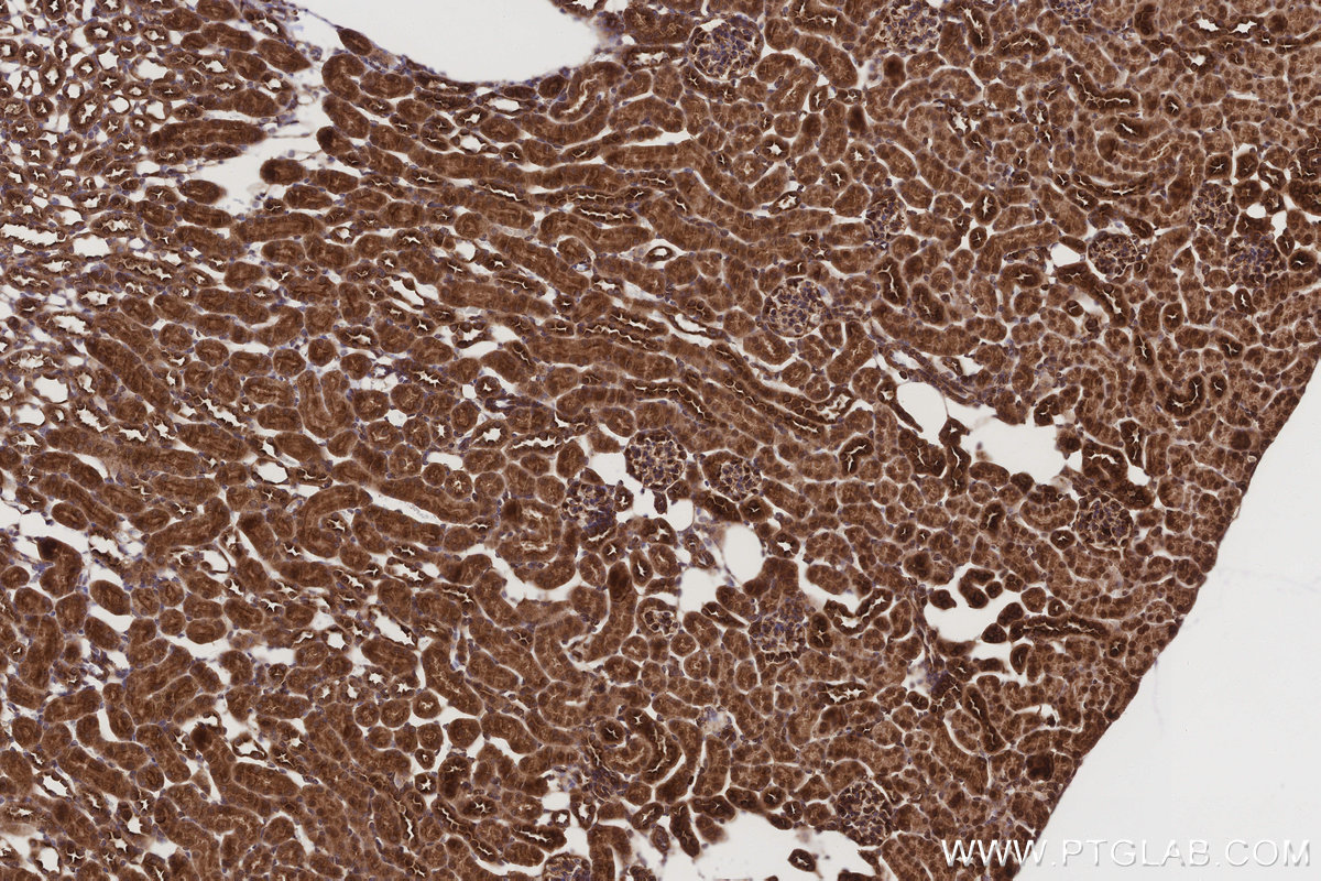 Immunohistochemical analysis of paraffin-embedded mouse kidney tissue slide using KHC3210 (PTPN9 IHC Kit).