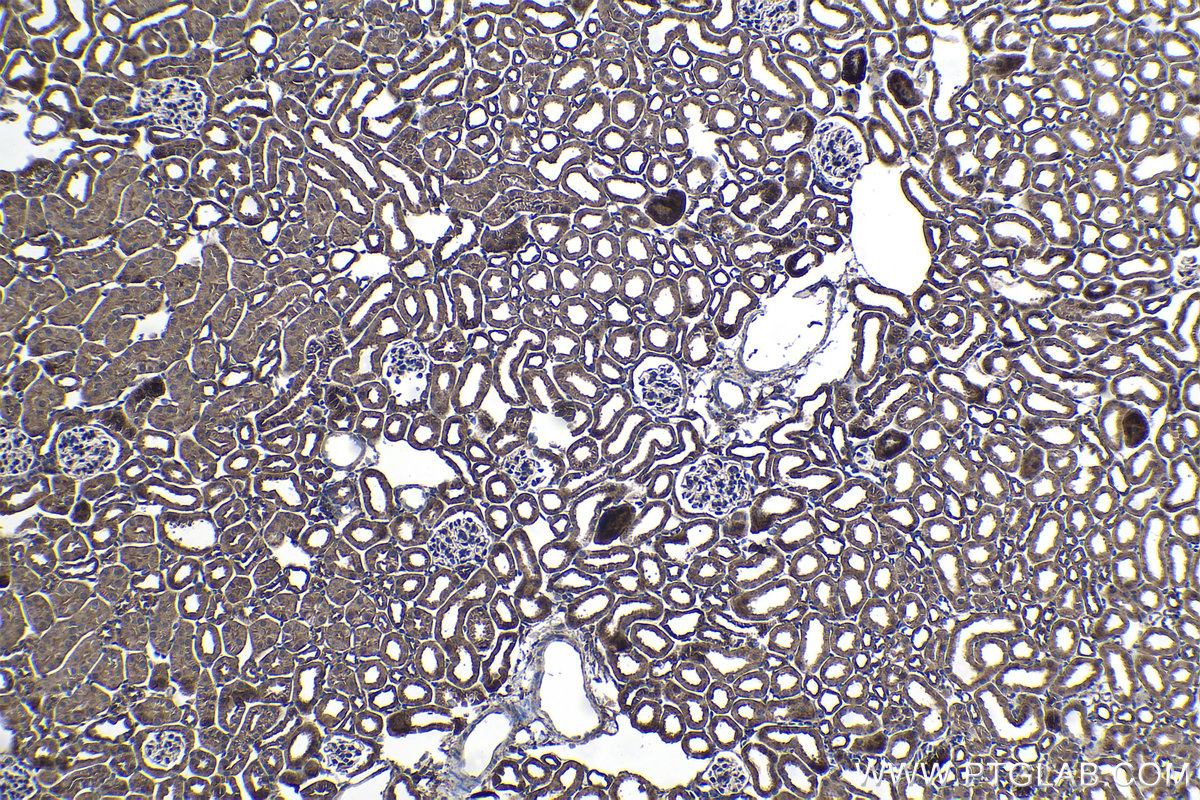 Immunohistochemical analysis of paraffin-embedded mouse kidney tissue slide using KHC1073 (PTPRA IHC Kit).