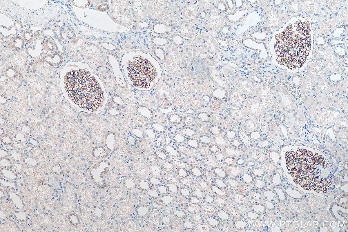 Immunohistochemical analysis of paraffin-embedded human kidney tissue slide using KHC0082 (PTPRO IHC Kit).