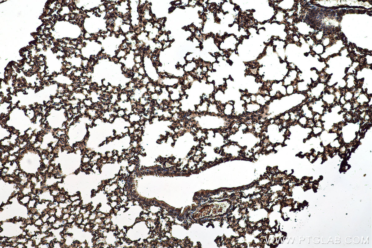 Immunohistochemical analysis of paraffin-embedded mouse lung tissue slide using KHC0677 (PTRF IHC Kit).