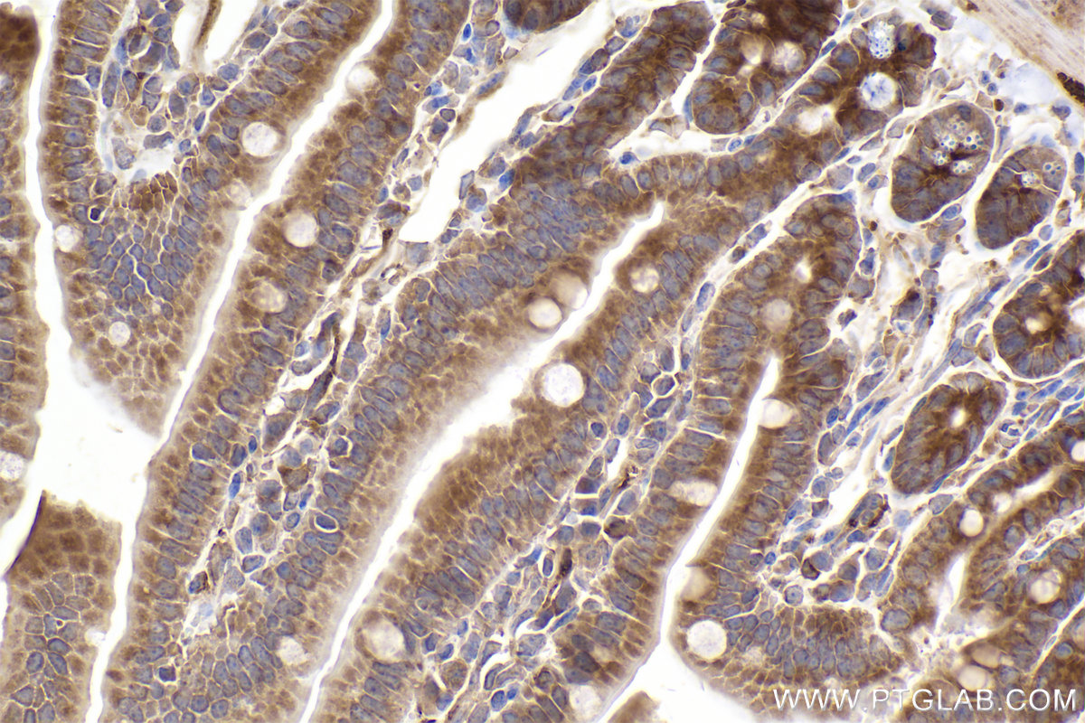 Immunohistochemical analysis of paraffin-embedded mouse small intestine tissue slide using KHC2515 (PUM1 IHC Kit).