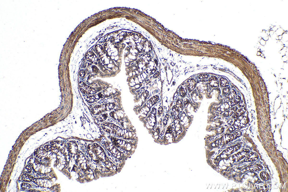 Immunohistochemical analysis of paraffin-embedded mouse colon tissue slide using KHC0833 (PYCR1 IHC Kit).