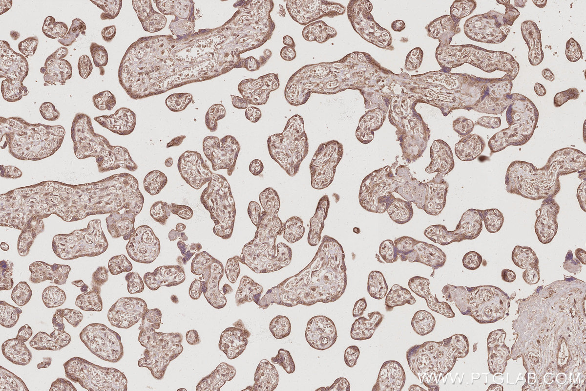 Immunohistochemical analysis of paraffin-embedded human placenta tissue slide using KHC3069 (Plakophilin 3 IHC Kit).