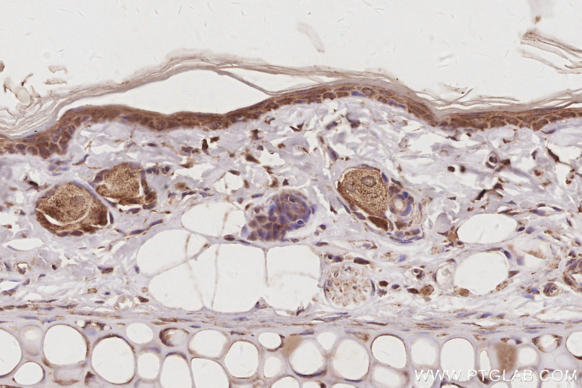 Immunohistochemical analysis of paraffin-embedded rat skin tissue slide using KHC3069 (Plakophilin 3 IHC Kit).