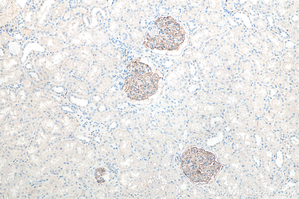 Immunohistochemical analysis of paraffin-embedded human kidney tissue slide using KHC0087 (Podocalyxin IHC Kit).