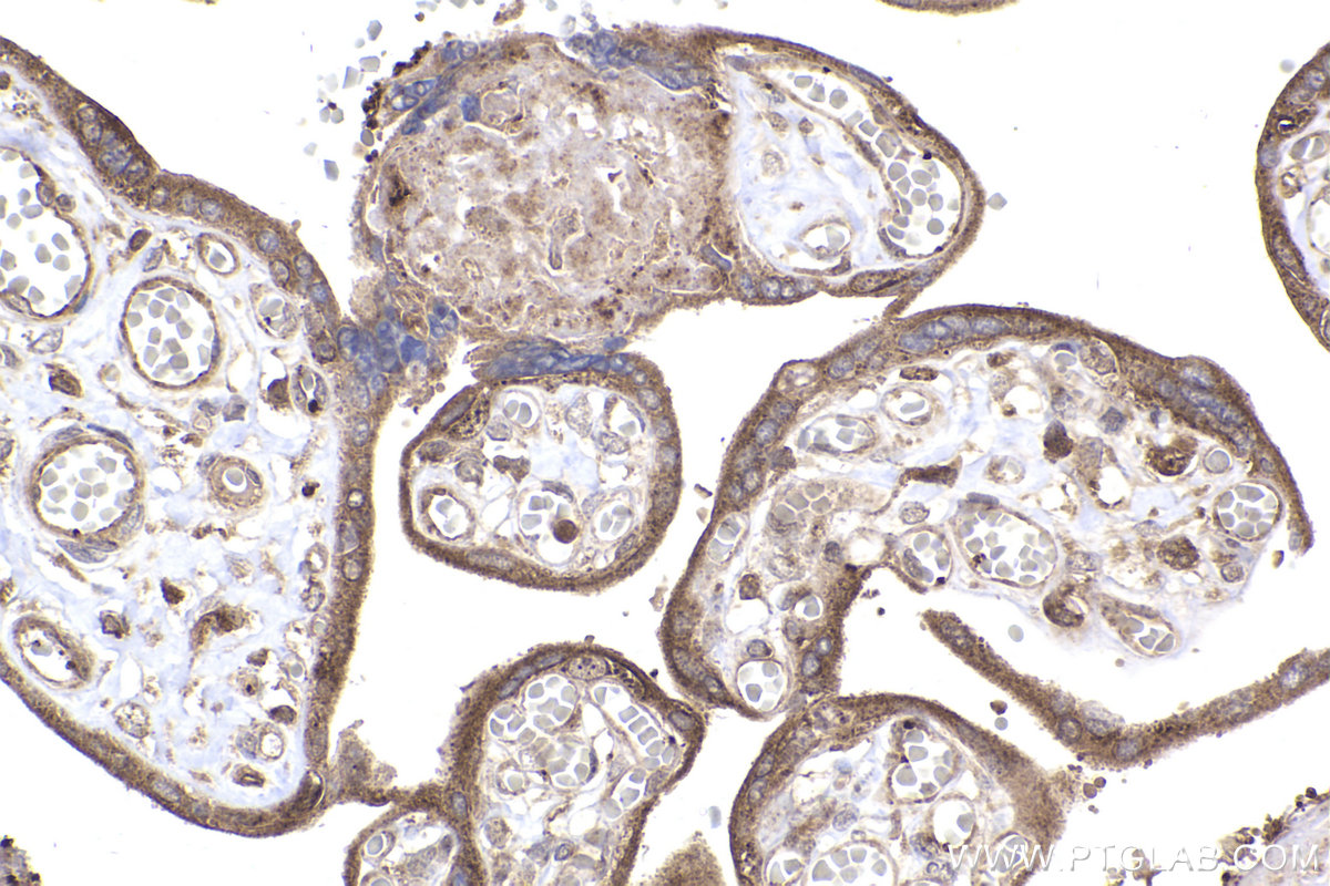 Immunohistochemical analysis of paraffin-embedded human placenta tissue slide using KHC2351 (RAB11A/B IHC Kit).
