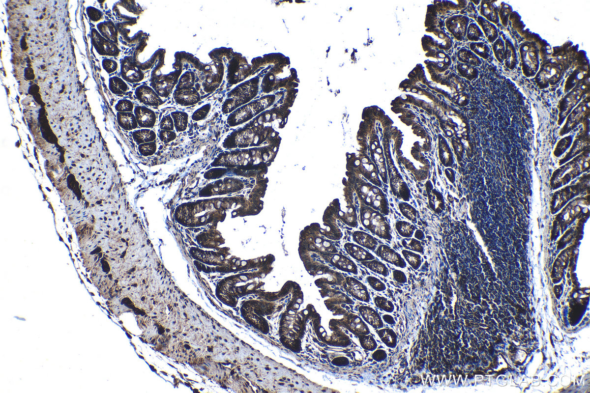 Immunohistochemical analysis of paraffin-embedded mouse colon tissue slide using KHC1276 (RAB11FIP5 IHC Kit).