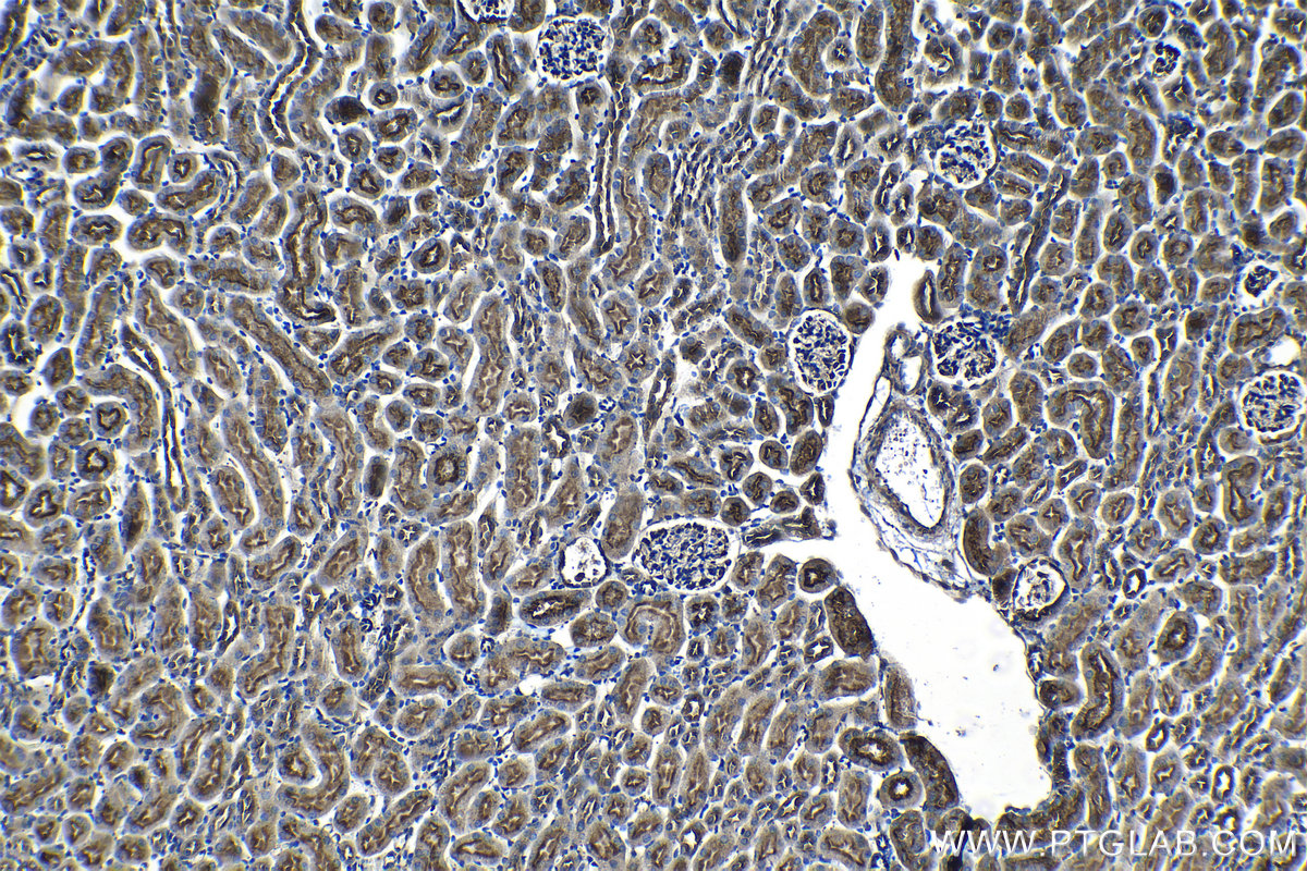 Immunohistochemical analysis of paraffin-embedded mouse kidney tissue slide using KHC1276 (RAB11FIP5 IHC Kit).