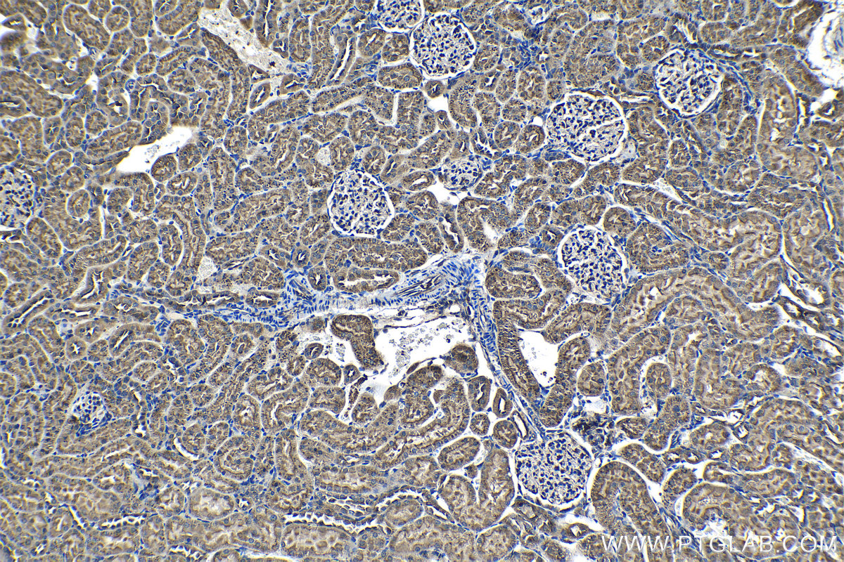 Immunohistochemical analysis of paraffin-embedded rat kidney tissue slide using KHC1276 (RAB11FIP5 IHC Kit).