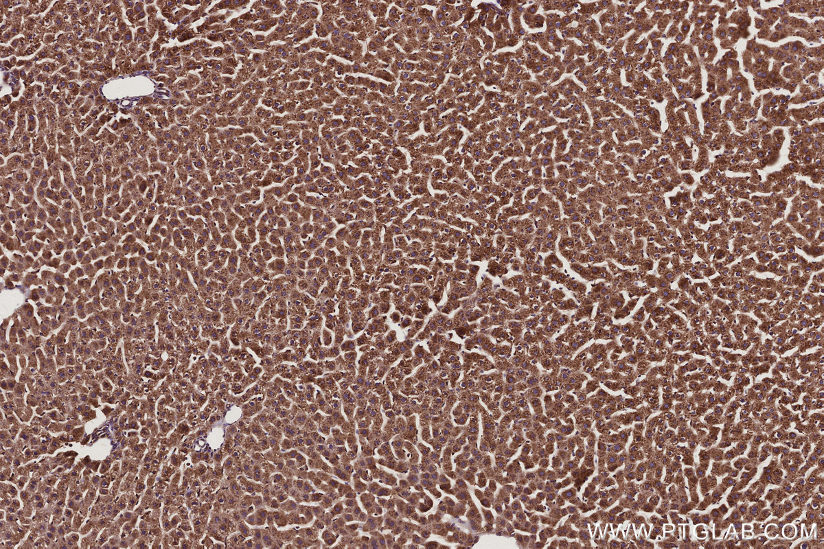 Immunohistochemical analysis of paraffin-embedded rat liver tissue slide using KHC2935 (RAB18 IHC Kit).