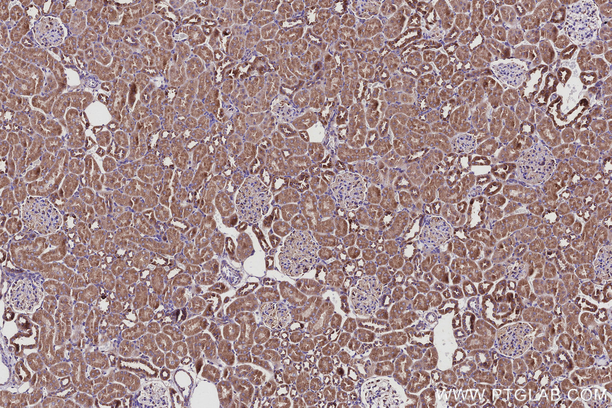 Immunohistochemical analysis of paraffin-embedded rat kidney tissue slide using KHC2935 (RAB18 IHC Kit).