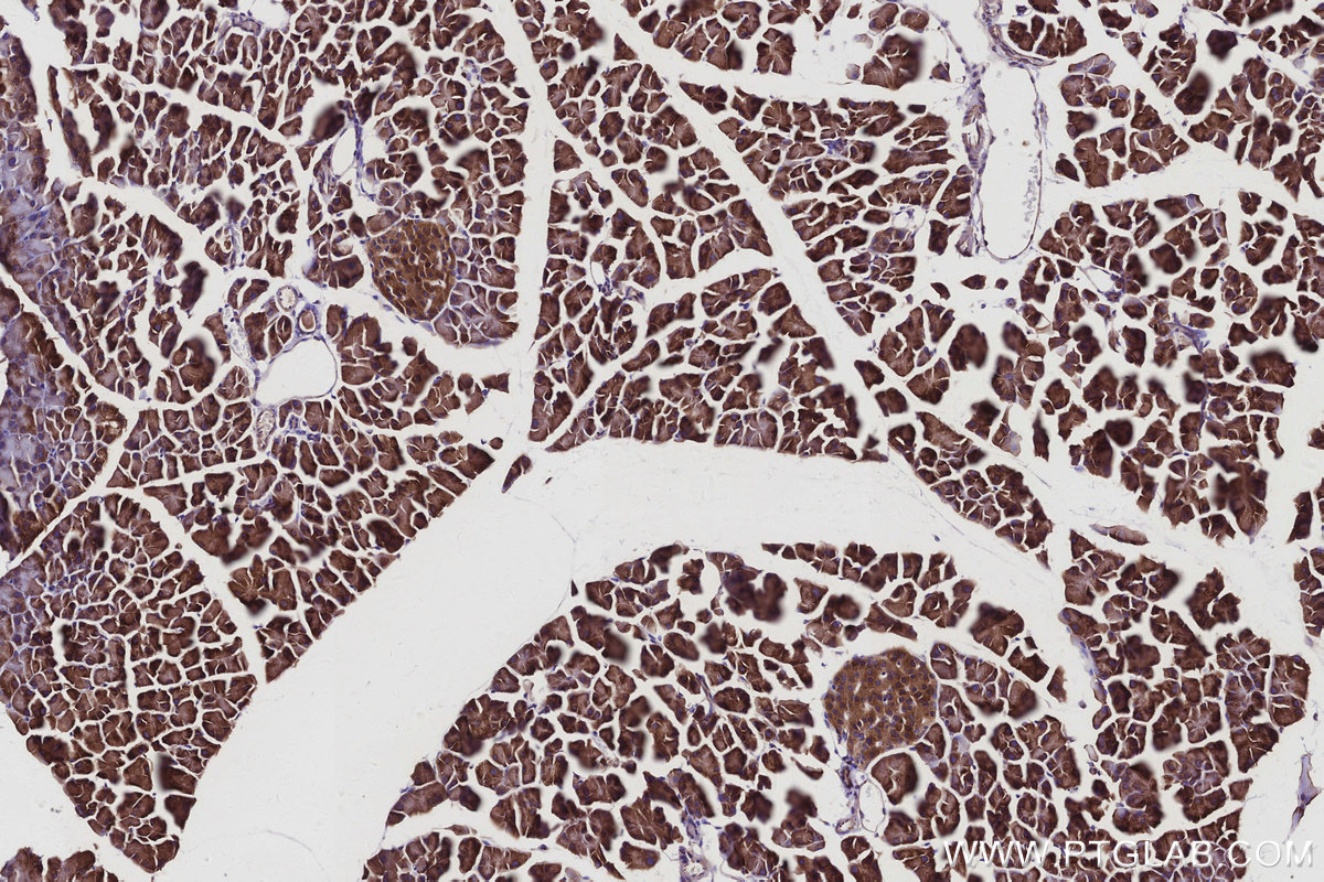 Immunohistochemical analysis of paraffin-embedded mouse pancreas tissue slide using KHC2935 (RAB18 IHC Kit).