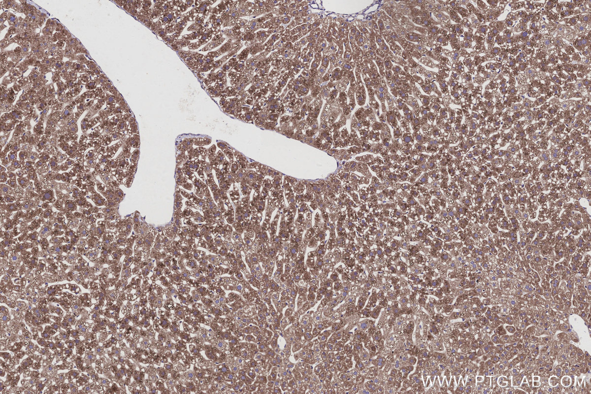 Immunohistochemical analysis of paraffin-embedded mouse liver tissue slide using KHC2935 (RAB18 IHC Kit).