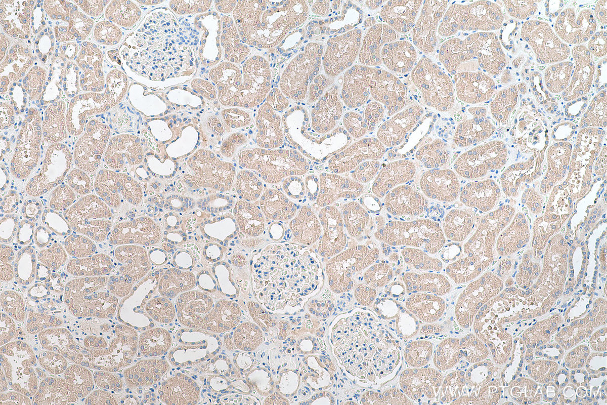 Immunohistochemical analysis of paraffin-embedded human kidney tissue slide using KHC0689 (RAB1A IHC Kit).