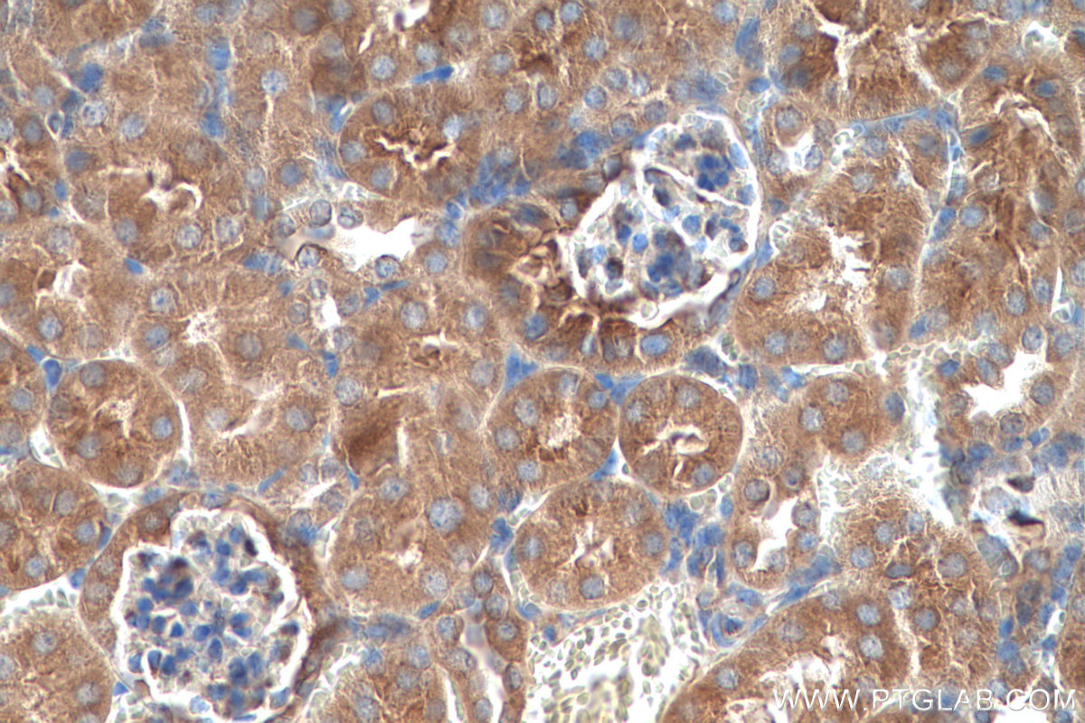 Immunohistochemical analysis of paraffin-embedded mouse kidney tissue slide using KHC0689 (RAB1A IHC Kit).