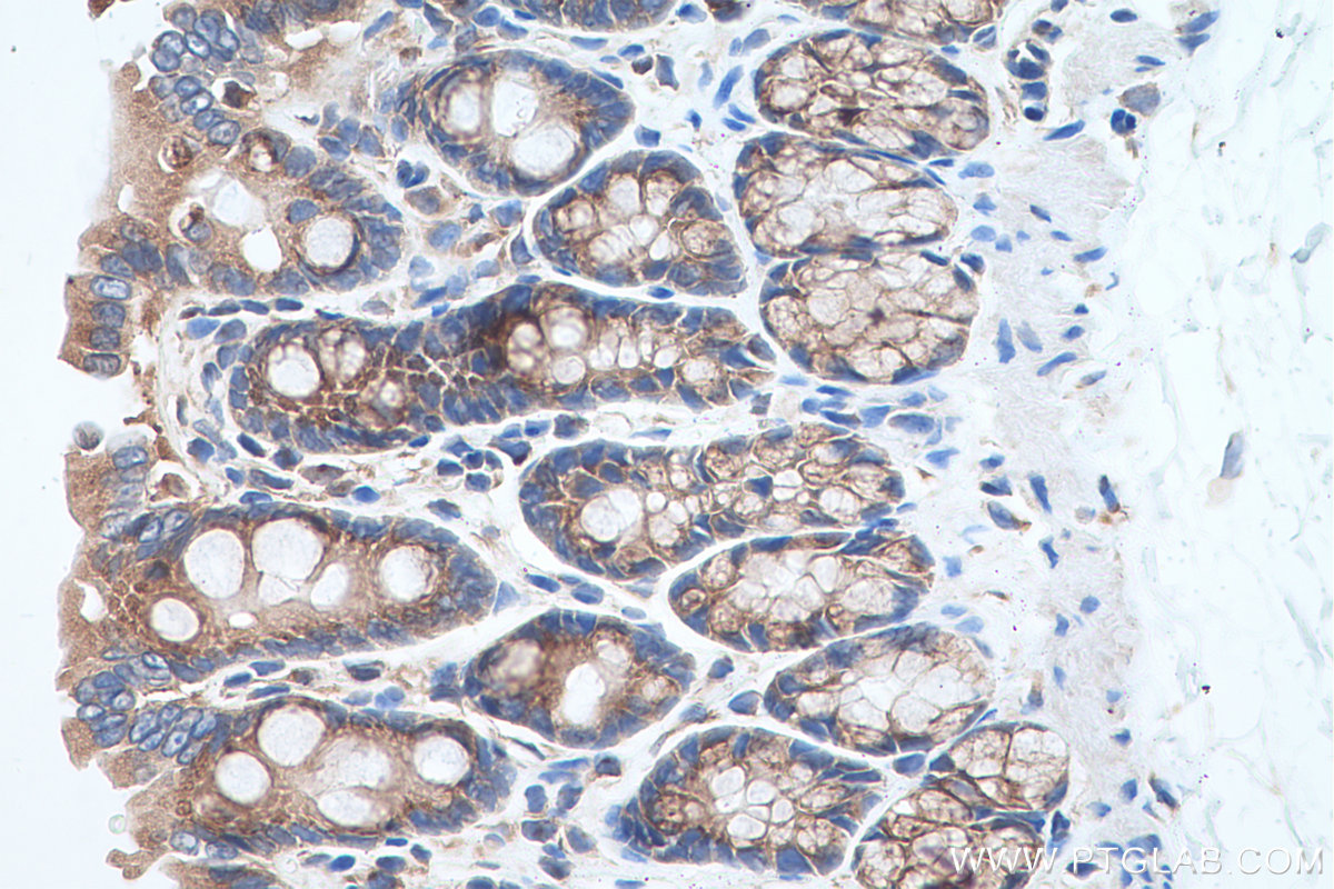 Immunohistochemical analysis of paraffin-embedded rat colon tissue slide using KHC0689 (RAB1A IHC Kit).