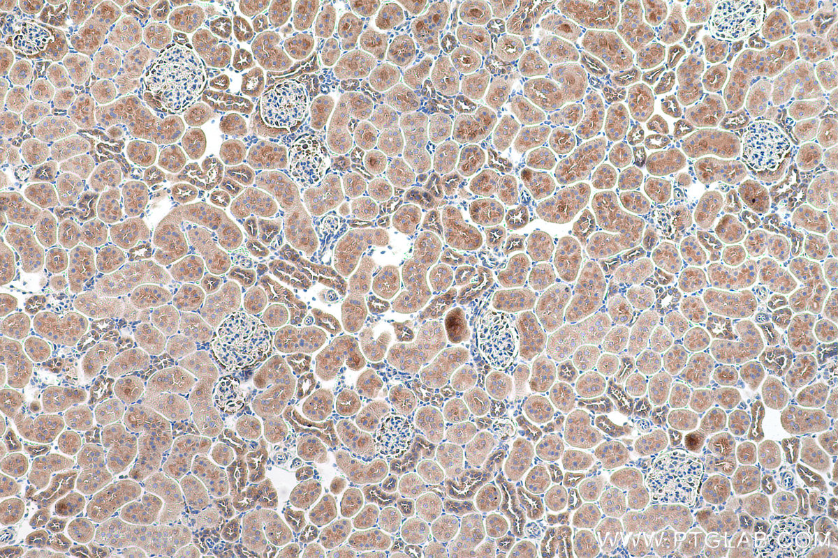 Immunohistochemical analysis of paraffin-embedded rat kidney tissue slide using KHC0689 (RAB1A IHC Kit).