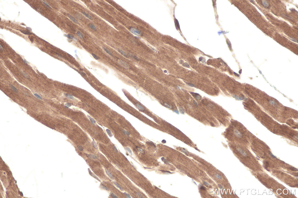 Immunohistochemical analysis of paraffin-embedded mouse heart tissue slide using KHC0838 (RAB1B IHC Kit).