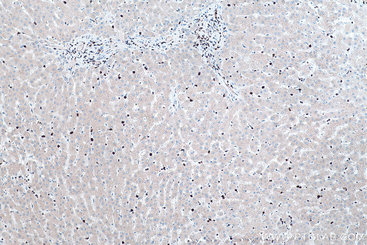 Immunohistochemical analysis of paraffin-embedded human liver tissue slide using KHC0450 (RAB27A IHC Kit).