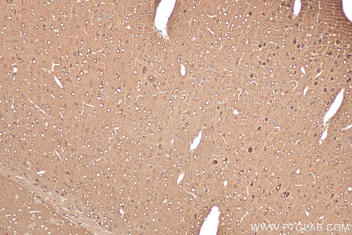 Immunohistochemical analysis of paraffin-embedded mouse brain tissue slide using KHC0912 (RAB2A IHC Kit).