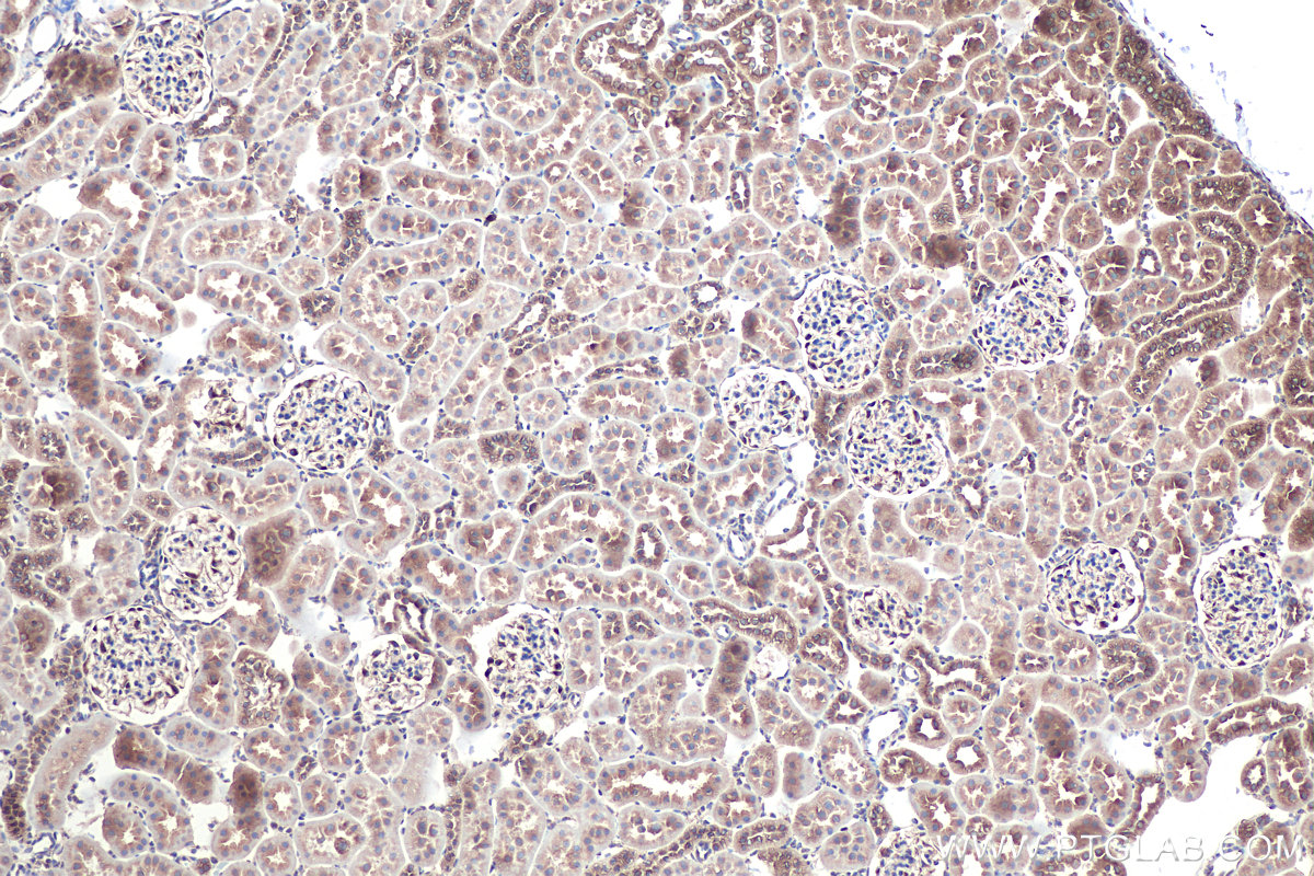 Immunohistochemical analysis of paraffin-embedded rat kidney tissue slide using KHC0912 (RAB2A IHC Kit).