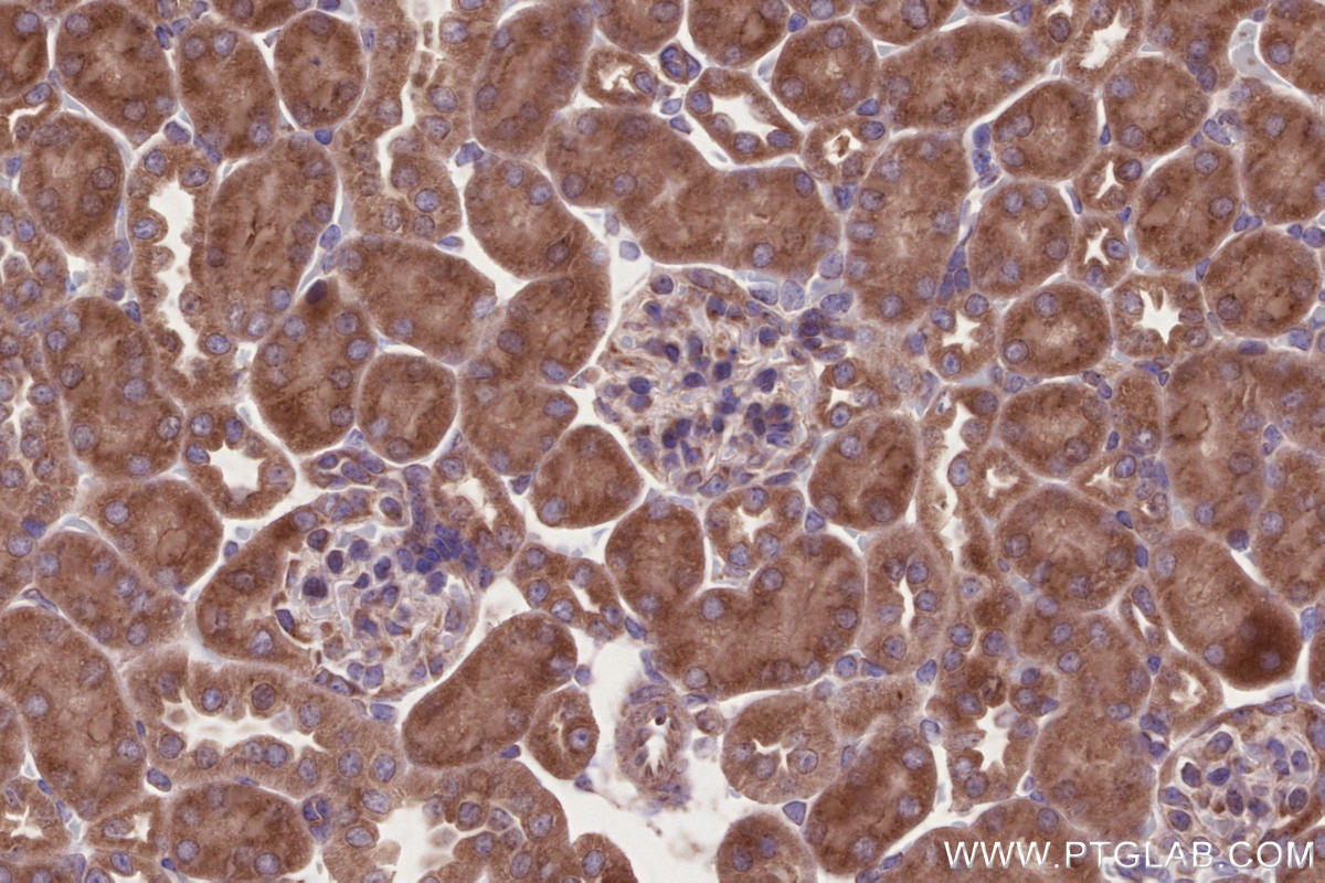 Immunohistochemical analysis of paraffin-embedded mouse kidney tissue slide using KHC2732 (RAB2B IHC Kit).